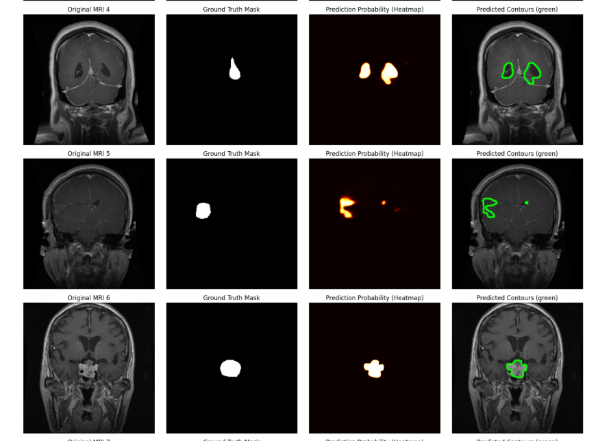 440025Advanced Machine Learning Model Development for Complex Projects